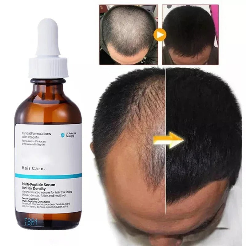 THE ORDINARY MULTI-PEPTIDE SERUM FOR HAIR DENSITY 60ML