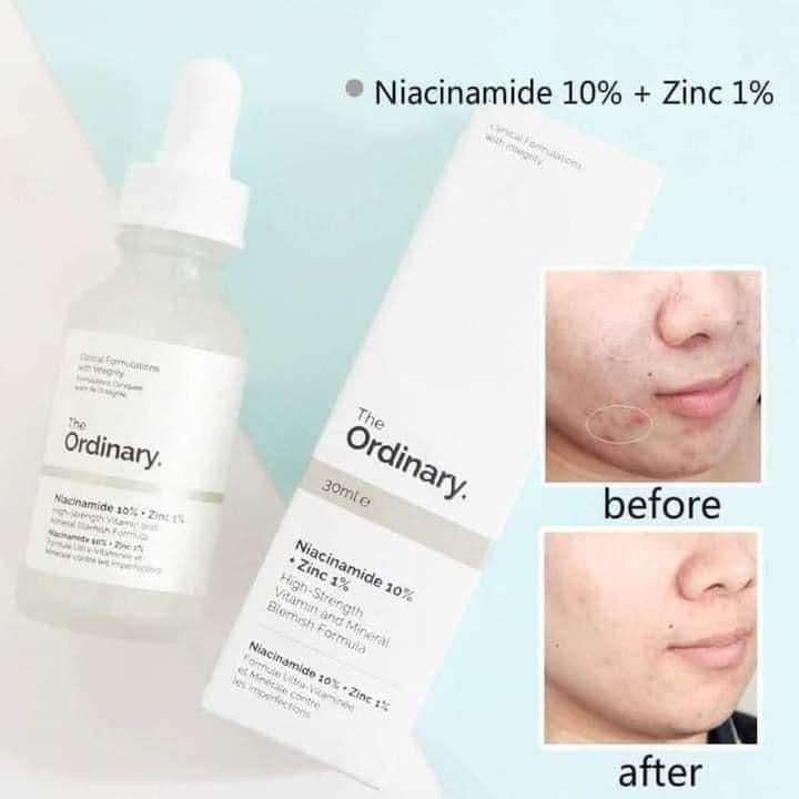 The Ordinary Niacinamide 10%+ Zinc 1% Serum 30mL - Made in Canada