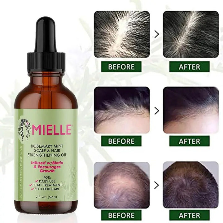 Mielle 59ML Original Rosemary Oil For Organics Hair Loss Treatment